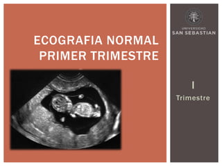 I
Trimestre
ECOGRAFIA NORMAL
PRIMER TRIMESTRE
 