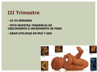 III Trimestre
• 32-34 SEMANAS
• FETO MUESTRA TENDENCIA DE
CRECIMIENTO E INCREMENTO DE PESO
• GRAN UTILIDAD EN PEG Y GEG
 