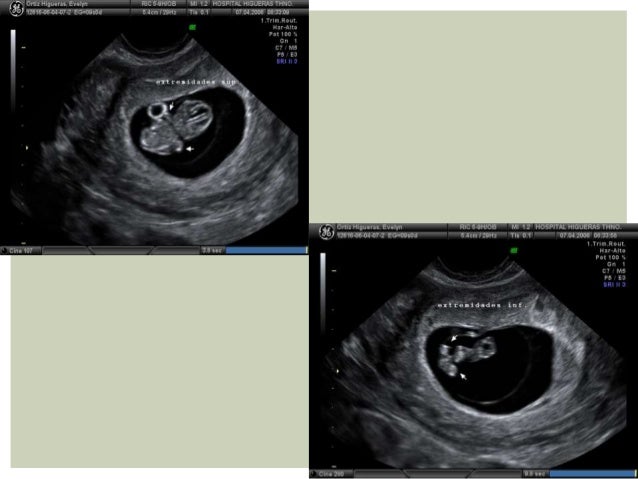 ecografia obstetrica