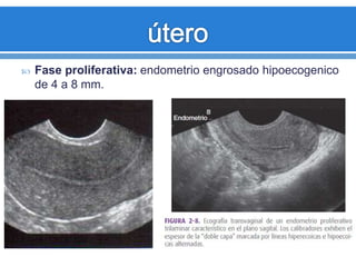  Fase proliferativa: endometrio engrosado hipoecogenico
de 4 a 8 mm.
 