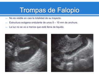  No es visible en casi la totalidad de su trayecto.
 Estructura ecógena ondulante de unos 8 – 10 mm de anchura.
 La luz no se ve a menos que esté llena de liquido.
 