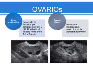 desarrollo de
folículos por
estimulo de FSH y
LH. Día 8 o 9, el
folículo mide entre
1.8 y 2,5 cm.
Fase
proliferativa:
estructura
hipoecoica o
isoecoica en la
periferia del ovario.
Cuerpo
lúteo:
 