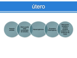 Aspecto
variable.
Útero puede
estar
aumentado
de tamaño.
Hipoecogénicos.
Ecopatrón
Heterogéneo.
Atenuación
acústica o
sombra
acústica
posterior, sin
evidencia de
masa.
 