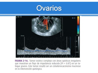 Ecorafa loza-160627235525