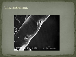 Trichoderma.
 