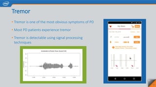 Tremor
• Tremor is one of the most obvious symptoms of PD
• Most PD patients experience tremor
• Tremor is detectable using signal processing
techniques
27
 