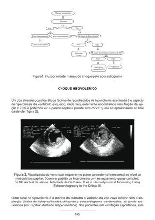 Figura1. Fluxograma de manejo do choque pelo ecocardiograma
Choque hipovolêmico
Um dos sinais ecocardiográficos facilmente reconhecidos na hipovolemia acentuada é o aspecto
de hipercinesia do ventrículo esquerdo, onde frequentemente encontramos uma fração de eje-
ção > 70% e podemos ver a parede septal e parede livre do VE quase se aproximarem ao final
da sístole (figura 2).
Figura 2. Visualização do ventrículo esquerdo no plano paraesternal transversal ao nível da
musculatura papilar. Observar padrão de hipercinesia com esvaziamento quase completo
do VE ao final da sístole. Adaptado de De Baker, D et al. Hemodynamical Monitoring Using
Echocardiography in the Critical Ill.
Outro sinal de hipovolemia é a medida do diâmetro e variação da veia cava inferior com a res-
piração (índice de colapsabilidade), utilizando o ecocardiograma transtorácico, na janela sub-
-xifóidea (ver capítulo de fluido responsividade). Nos pacientes em ventilação espontânea, este
108
Apostila Ecotin_2012.indb 108 29/02/2012 09:03:05
 