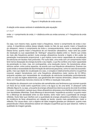 11
Figura 4: Amplitude de onda sonora
A relação entre essas variáveis é estabelecida pela equação:
c = λ x f
onde: c = comprimento de onda; λ = distância entre as ondas sonoras; e f = frequência da onda
sonora.
Ou seja, num mesmo meio, quanto maior a frequência, menor o comprimento de onda e vice-
-versa. A importância prática dessa relação reside no fato de que quanto maior a frequência
do ultrassom, menor o comprimento de onda e, consequentemente, maior a resolução obtida.
Dessa forma, quanto maior a frequência de um transdutor ultrassônico, maior será seu poder
de resolução ou sua capacidade de “distinguir” pequenos objetos entre si. Ocorre que ondas
de mais alta frequência perdem muita energia ultrassônica durante o trajeto e têm poder de
penetração inversamente proporcional, o que implica numa menor capacidade de vizualização
de estruturas em tecidos mais profundos. Por outro lado, uma onda com um comprimento maior
terá menos dissipação de energia durante o seu trajeto, o que lhe confere uma maior capacidade
de penetração no meio, mas, em contrapartida, uma resolução menor. Os transdutores ultras-
sônicos variam, entre outros aspectos, de acordo com sua frequência ultrassônica. Exames nos
quais existe a necessidade de discriminação de estruturas pequenas, como no caso da ecocardio-
grafia, mas cujo objeto de vizualização (no caso, o coração) é relativamente próximo à superfície
corporal, exigem transdutores com uma frequência ultrassônica maior (acima de 5,0 MHz),
enquanto aqueles com necessidade de vizualização de estruturas localizadas profundamente,
como no caso de órgãos abdominais, que geralmente têm maiores dimensōes, utilizam transdu-
tores com frequências menores (menos de 3,0 MHz) e resolução mais pobre.
As relações do ultrasssom com os tecidos são semelhantes aos fenômenos que ocorrem quando
um feixe de luz incide sobre superfícies como a da água ou de uma lente. O ultrassom sofre
reflexão (figura 5), ou seja, uma parte da energia ultrassônica retorna ao ponto de onde foi emitida
(no caso, o transdutor), sempre que o feixe ultrassônico atravessa uma interface entre dois meios
com densidades diferentes. Essa diferença é denominada “impedância acústica” e quanto maior
for a diferença de densidade entre os dois tecidos, tanto maior será a quantidade de energia
refletida. Outro fator que interfere com a quantidade de energia ultrassônica refletida é o ângulo
de incidência do feixe ultrassônico em relação ao tecido: quanto mais perpendicular, maior a
reflexão. Por causa disso, com o objetivo de obter imagens geradas por ultrassom, quanto mais
perpendicular o feixe ultrassônico estiver em relação à superfície que se quer observar, melhor a
qualidade da imagem gerada.
Apostila Ecotin_2012.indb 11 29/02/2012 09:02:53
 