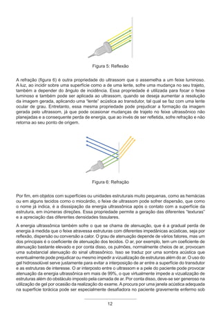 12
Figura 5: Reflexão
A refração (figura 6) é outra propriedade do ultrassom que o assemelha a um feixe luminoso.
A luz, ao incidir sobre uma superfície como a de uma lente, sofre uma mudança no seu trajeto,
também a depender do ângulo de incidência. Essa propriedade é utilizada para focar o feixe
luminoso e também pode ser aplicada ao ultrassom, quando se deseja aumentar a resolução
da imagem gerada, aplicando uma “lente” acústica ao transdutor, tal qual se faz com uma lente
ocular de grau. Entretanto, essa mesma propriedade pode prejudicar a formação da imagem
gerada pelo ultrassom, já que pode ocasionar mudanças de trajeto no feixe ultrassônico não
planejadas e a consequente perda de energia, que ao invés de ser refletida, sofre refração e não
retorna ao seu ponto de origem.
Figura 6: Refração
Por fim, em objetos com superfícies ou unidades estruturais muito pequenas, como as hemácias
ou em alguns tecidos como o miocárdio, o feixe de ultrassom pode sofrer dispersão, que como
o nome já indica, é a disssipação da energia ultrassônica após o contato com a superfície da
estrutura, em inúmeras direções. Essa propriedade permite a geração das diferentes “texturas”
e a apreciação das diferentes densidades tissulares.
A energia ultrassônica também sofre o que se chama de atenuação, que é a gradual perda de
energia à medida que o feixe atravessa estruturas com diferentes impedânicas acústicas, seja por
reflexão, dispersão ou conversão a calor. O grau de atenuação depende de vários fatores, mas um
dos principais é o coeficiente de atenuação dos tecidos. O ar, por exemplo, tem um coeficiente de
atenuação bastante elevado e por conta disso, os pulmões, normalmente cheios de ar, provocam
uma substancial atenuação do sinal ultrassônico. Isso se traduz por uma sombra acústica que
eventualmente pode prejudicar ou mesmo impedir a vizualização de estruturas além do ar. O uso do
gel hidrossolúvel serve justamente para evitar a interposição de ar entre a superfície do transdutor
e as estruturas de interesse. O ar interposto entre o ultrassom e a pele do paciente pode provocar
atenuação da energia ultrassônica em mais de 99%, o que virtualmente impede a vizualização de
estruturas além do obstáculo imposto pela camada de ar. Por conta disso, deve-se ser generoso na
utilização de gel por ocasião da realização do exame. A procura por uma janela acústica adequada
na superfície torácica pode ser especialmente desafiadora no paciente gravemente enfermo sob
Apostila Ecotin_2012.indb 12 29/02/2012 09:02:53
 