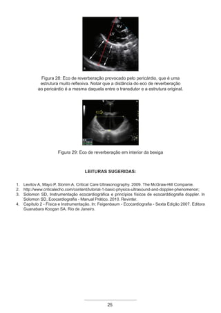 25
!
Figura 28: Eco de reverberação provocado pelo pericárdio, que é uma
estrutura muito reflexiva. Notar que a distância do eco de reverberação
ao pericárdio é a mesma daquela entre o transdutor e a estrutura original.
Figura 29: Eco de reverberação em interior da bexiga
Leituras Sugeridas:
1. Levitov A, Mayo P, Slonim A. Critical Care Ultrasonography. 2009. The McGraw-Hill Companie.
2. http://www.criticalecho.com/content/tutorial-1-basic-physics-ultrasound-and-doppler-phenomenon;
3. Solomon SD, Instrumentação ecocardiográfica e princípios físicos de ecocarddiografia doppler. In
Solomon SD, Ecocardiografia - Manual Prático. 2010. Revinter.
4. Capítulo 2 - Física e Instrumentação. In: Feigenbaum - Ecocardiografia - Sexta Edição 2007. Editora
Guanabara Koogan SA. Rio de Janeiro.
Apostila Ecotin_2012.indb 25 29/02/2012 09:02:57
 