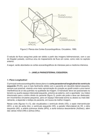 32
Figura 2: Planos dos Cortes Ecocardiográficos. Circulation, 1980.
O estudo do fluxo sanguíneo pode ser obtido a partir das imagens bidimensionais, com o uso
do Doppler pulsado, contínuo e/ou do mapeamento de fluxo em cores, como visto no capítulo
anterior.
A seguir, serão abordados os cortes ecocardiográficos de interesse para a medicina intensiva.
I – Janela Paraesternal Esquerda:
1. Plano Longitudinal:
O principal corte ecocardiográfico desse plano é o corte paraesternal longitudinal do ventrículo
esquerdo (PLVE), que é mais facilmente obtido com o paciente em decúbito lateral esquerdo,
sempre que possível, visando uma maior aproximação do coração ao gradil costal e uma menor
interferência do ar dos pulmões na qualidade da imagem. O transdutor deve ser posicionado no
terceiro ou quarto espaço intercostal esquerdo, próximo ao esterno, com o apontador (ou índex)
direcionado para o ombro direito do paciente (figura 3), porém ele pode e deve ser deslocado,
em movimentos circulares pequenos, para um espaço intercostal acima ou abaixo ou mais late-
ralmente, a depender o biótipo do paciente, em busca da melhor imagem.
Nesse corte (figuras 4 e 5), são visualizados o ventrículo direito (VD), o septo interventricular
(SIV), a raiz da aorta (Ao), o ventrículo esquerdo (VE), a parede ínfero-lateral do VE, o átrio
esquerdo (AE), a artéria pulmonar direita (APd), a aorta torácica descendente (AoDesc), além
das valvas mitral (VM) e aórtica (VAo).
Apostila Ecotin_2012.indb 32 29/02/2012 09:02:57
 