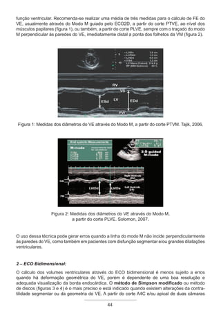 44
função ventricular. Recomenda-se realizar uma média de três medidas para o cálculo de FE do
VE, usualmente através do Modo M guiado pelo ECO2D, a partir do corte PTVE, ao nível dos
músculos papilares (figura 1), ou também, a partir do corte PLVE, sempre com o traçado do modo
M perpendicular às paredes do VE, imediatamente distal a ponta dos folhetos da VM (figura 2).
Figura 1: Medidas dos diâmetros do VE através do Modo M, a partir do corte PTVM. Tajik, 2006.
Figura 2: Medidas dos diâmetros do VE através do Modo M,
a partir do corte PLVE. Solomon, 2007.
O uso dessa técnica pode gerar erros quando a linha do modo M não incide perpendicularmente
às paredes do VE, como também em pacientes com disfunção segmentar e/ou grandes dilatações
ventriculares.
2 – ECO Bidimensional:
O cálculo dos volumes ventriculares através do ECO bidimensional é menos sujeito a erros
quando há deformação geométrica do VE, porém é dependente de uma boa resolução e
adequada visualização da borda endocárdica. O método de Simpson modificado ou método
de discos (figuras 3 e 4) é o mais preciso e está indicado quando existem alterações da contra-
tilidade segmentar ou da geometria do VE. A partir do corte A4C e/ou apical de duas câmaras
Apostila Ecotin_2012.indb 44 29/02/2012 09:02:59
 