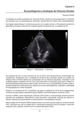 51
Capítulo 5
Ecocardiograma e Avaliação de Câmaras Direitas
Ricardo Cordioli
A avaliação da função quantitativa de ventrículo direito, devido sua forma geométrica, é difícil de
ser realizada com o ecocardiograma, sobretudo, quando feito por médico não ecocardiografista.
Na imagem abaixo (figura 1), observa-se que em um coração normal, o VD apresenta uma forma
geométrica triangular, difícil de ser avaliado quando comparado com a avaliação do VE.
Figura 1 – Corte Apical – 4 câmaras.
Em ambiente de UTI, no que concerne ao uso do ECO como ferramenta de monitorização he-
modinâmica, acreditamos que a avaliação do tamanho das cavidades direitas do coração, da
relação entre o tamanho destas em comparação com as câmaras esquerdas, associado a uma
avaliação global e qualitativa de VD, já é muito importante e representa aquilo que o médico in-
tensivista/emergencista precisa saber avaliar. Soma-se a isto, a possibilidade de poder avaliar a
pressão sistólica da artéria pulmonar através do uso do ecocardiograma, avaliando a velocidade
da regurgitação em valvar tricúspide.
Existem, em ambiente de UTI, 2 situações nas quais a avaliação do VD se torna indispensável:
síndrome de desconforto respiratório agudo (SDRA) e tromboembolismo pulmonar (TEP).
Durante a SDRA, ocorre hipertensão pulmonar (HP) devido à vasoconstrição arterial pulmonar
induzida por mediadores inflamatórios e pela hipoxemia, compressão vascular por edema ou
fibrose, fenômeno tromboembólico no leito pulmonar e remodelação vascular.
Esta situação de HP durante SDRA acaba levando a aumento da pós-carga ao ventrículo direito
(VD), ventrículo que não se adapta bem a sobrecarga pressórica como se adapta o ventrículo
esquerdo (VE), podendo culminar com cor pulmonale agudo (CPA).
Apostila Ecotin_2012.indb 51 29/02/2012 09:03:00
 