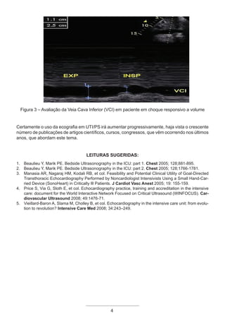 Figura 3 – Avaliação da Veia Cava Inferior (VCI) em paciente em choque responsivo a volume
Certamente o uso da ecografia em UTI/PS irá aumentar progressivamente, haja vista o crescente
número de publicações de artigos científicos, cursos, congressos, que vêm ocorrendo nos últimos
anos, que abordam este tema.
Leituras sugeridas:
1. Beaulieu Y, Marik PE. Bedside Ultrasonography in the ICU: part 1. Chest 2005; 128;881-895.
2. Beaulieu Y, Marik PE. Bedside Ultrasonography in the ICU: part 2. Chest 2005; 128;1766-1781.
3. Manasia AR, Nagaraj HM, Kodali RB, et col. Feasibility and Potential Clinical Utility of Goal-Directed
Transthoracic Echocardiography Performed by Noncardiologist Intensivists Using a Small Hand-Car-
ried Device (SonoHeart) in Critically Ill Patients. J Cardiot Vasc Anest 2005; 19: 155-159.
4. Price S, Via G, Sloth E, et col. Echocardiography practice, training and accreditation in the intensive
care: document for the World Interactive Network Focused on Critical Ultrasound (WINFOCUS). Car-
diovascular Ultrasound 2008; 49:1476-71.
5. Vieillard-Baron A, Slama M, Cholley B, et col. Echocardiography in the intensive care unit: from evolu-
tion to revolution? Intensive Care Med 2008; 34:243–249.
4
Apostila Ecotin_2012.indb 4 29/02/2012 09:02:53
 