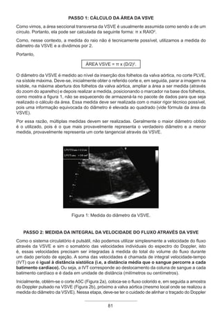 81
PASSO 1: CÁLCULO DA ÁREA DA VSVE
Como vimos, a área seccional transversa da VSVE é usualmente assumida como sendo a de um
círculo. Portanto, ela pode ser calculada da seguinte forma: π x RAIO2
.
Como, nesse contexto, a medida do raio não é tecnicamente possível, utilizamos a medida do
diâmetro da VSVE e a dividimos por 2.
Portanto,
ÁREA VSVE = π x (D/2)2
.
O diâmetro da VSVE é medido ao nível da inserção dos folhetos da valva aórtica, no corte PLVE,
na sístole máxima. Deve-se, inicialmente obter o referido corte e, em seguida, parar a imagem na
sístole, na máxima abertura dos folhetos da valva aórtica, ampliar a área a ser medida (através
do zoom do aparelho) e depois realizar a medida, posicionando o marcador na base dos folhetos,
como mostra a figura 1, não se esquecendo de armazená-la no pacote de dados para que seja
realizado o cálculo da área. Essa medida deve ser realizada com o maior rigor técnico possível,
pois uma informação equivocada do diâmetro é elevada ao quadrado (vide fórmula da área da
VSVE).
Por essa razão, múltiplas medidas devem ser realizadas. Geralmente o maior diâmetro obtido
é o utilizado, pois é o que mais provavelmente representa o verdadeiro diâmetro e a menor
medida, provavelmente representa um corte tangencial através da VSVE.
Figura 1: Medida do diâmetro da VSVE.
PASSO 2: MEDIDA DA INTEGRAL DA VELOCIDADE DO FLUXO ATRAVÉS DA VSVE
Como o sistema circulatório é pulsátil, não podemos utilizar simplesmente a velocidade do fluxo
através da VSVE e sim o somatório das velocidades individuais do espectro do Doppler, isto
é, essas velocidades precisam ser integradas à medida do total do volume do fluxo durante
um dado período de ejeção. A soma das velocidades é chamada de integral velocidade-tempo
(IVT) que é igual à distância sistólica (i.e, a distância média que o sangue percorre a cada
batimento cardíaco). Ou seja, a IVT corresponde ao deslocamento da coluna de sangue a cada
batimento cardíaco e é dada em unidade de distância (milímetros ou centímetros).
Inicialmente, obtém-se o corte A5C (Figura 2a), coloca-se o fluxo colorido e, em seguida a amostra
do Doppler pulsado na VSVE (Figura 2b), próximo a valva aórtica (mesmo local onde se realizou a
medida do diâmetro da VSVE). Nessa etapa, deve-se ter o cuidado de alinhar o traçado do Doppler
Apostila Ecotin_2012.indb 81 29/02/2012 09:03:03
 