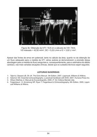 84
Figura 3b: Obtenção da IVT= 19,8 cm e cálculos do VS= 74ml,
VS indexado = 42,92 ml/m2
, DC = 5,22 L/min e IC = 3,02 L/ min2
.
Apesar das fontes de erros em potencial, tanto no cálculo da área, quanto no da obtenção de
um fluxo adequado para a medida da IVT, vários autores já demonstraram a precisão dessa
abordagem para a medida do fluxo sanguíneo e, consequentemente, para a estimativa do débito
cardíaco, nas mais variadas situações clínicas, desde que os cuidados técnicos sejam seguidos.
LEITURAS SUGERIDAS:
1- Tajik AJ, Deward JB, Oh JK. The Echo Manual. 3th Edition, 2007, Lippincott, Williams & Wilkins.
2- Solomon SD. Essential echocardiography: a practical handbook with DVD, 2007, Humana Press Inc.
3- Wilson Mathias Jr. Manual de Ecocardiografia, 2009. 2ª. Ed. Editora Manole Ltda.
4- Feigenbaum H, Armstrong WF, Ryan T. Feigenbaum’s Echocardiography, 6th Edition, 2005, Lippin-
cott Williams & Wilkins.
Apostila Ecotin_2012.indb 84 29/02/2012 09:03:03
 
