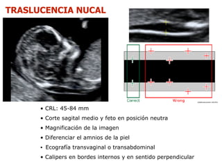 Ecografia del primer trimestre pdf hotsell