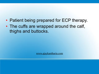 <ul><li>Patient being prepared for ECP therapy. </li></ul><ul><li>The cuffs are wrapped around the calf, thighs and buttoc...