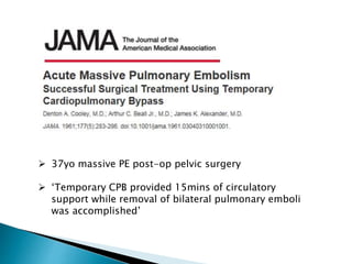  37yo massive PE post-op pelvic surgery
 ‘Temporary CPB provided 15mins of circulatory
support while removal of bilateral pulmonary emboli
was accomplished’
 