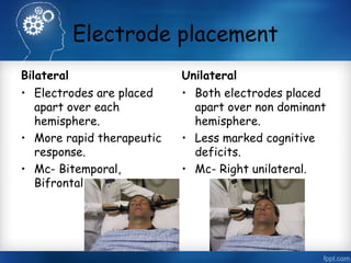 Electrode placement
Bilateral

Unilateral

• Electrodes are placed
apart over each
hemisphere.
• More rapid therapeutic
response.
• Mc- Bitemporal,
Bifrontal.

• Both electrodes placed
apart over non dominant
hemisphere.
• Less marked cognitive
deficits.
• Mc- Right unilateral.

 