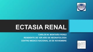 ECTASIA RENAL
CARLOS M. MONTAÑO PEREZ
RESIDENTE DE 1ER AÑO DE NEONATOLOGIA
CENTRO MEDICO NACIONAL 20 DE NOVIEMBRE
 