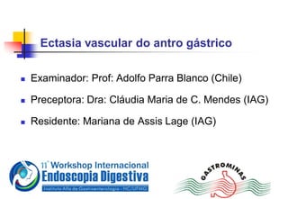 Ectasia vascular do antro gástrico
 Examinador: Prof: Adolfo Parra Blanco (Chile)
 Preceptora: Dra: Cláudia Maria de C. Mendes (IAG)
 Residente: Mariana de Assis Lage (IAG)
 