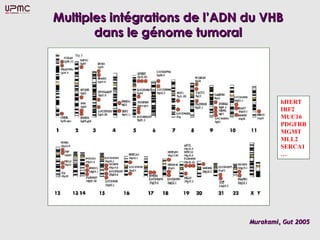 Multiples intégrations de lMultiples intégrations de l’ADN du VHB’ADN du VHB
dans le génome tumoraldans le génome tumoral
Murakami, Gut 2005Murakami, Gut 2005
hHERT
IRF2
MUC16
PDGFRB
MGMT
MLL2
SERCA1
…
 