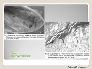 Fonte:
http://www.scielo.br



                       Ectima Contagioso
 