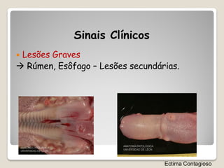 Sinais Clínicos
Lesões Graves
 Rúmen, Esôfago – Lesões secundárias.




                                  Ectima Contagioso
 