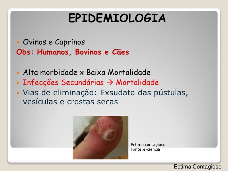 Ectima contagioso