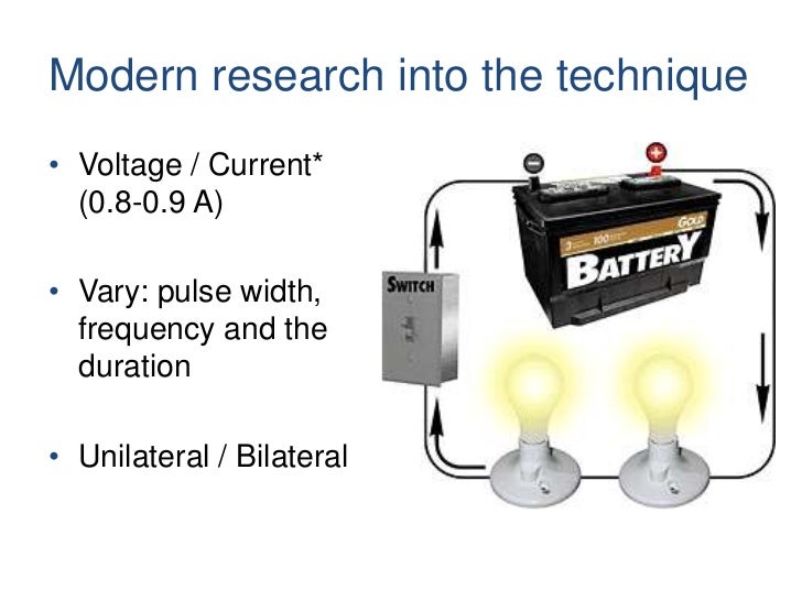 Electroconvulsive Therapy