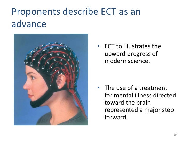 Electroconvulsive Therapy