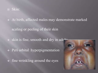  Skin:
 At birth, affected males may demonstrate marked
scaling or peeling of their skin
 skin is fine, smooth and dry in adults
 Peri orbital hyperpigmentation
 fine wrinkling around the eyes
 