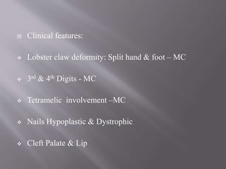  Clinical features:
 Lobster claw deformity: Split hand & foot – MC
 3rd & 4th Digits - MC
 Tetramelic involvement –MC
 Nails Hypoplastic & Dystrophic
 Cleft Palate & Lip
 