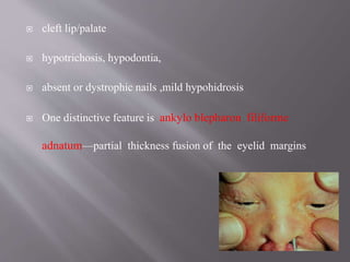  cleft lip/palate
 hypotrichosis, hypodontia,
 absent or dystrophic nails ,mild hypohidrosis
 One distinctive feature is ankylo blepharon filiforme
adnatum—partial thickness fusion of the eyelid margins
 