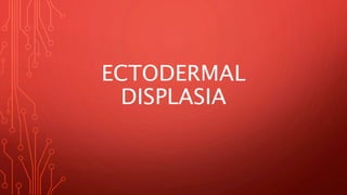 ECTODERMAL
DISPLASIA
 