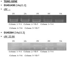 • TGM1 GENE
• D14S1430 (14q11.2)
• cM …
• D14S264 (14q11.2)
• cM 22.66
 