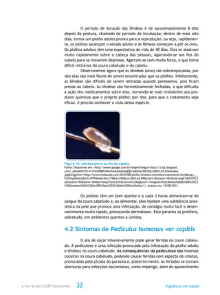 e-Tec Brasil/CEMF/Unimontes Vigilância em Saúde32
O período de duração das lêndeas é de aproximadamente 8 dias
depois da postura, chamado de período de incubação; dentro de mais oito
dias, temos um piolho adulto pronto para a reprodução, ou seja, rapidamen-
te, os piolhos alcançam o estado adulto e as fêmeas começam a pôr os ovos.
Os piolhos adultos têm uma expectativa de vida de 40 dias. Eles se alastram
muito rapidamente sobre a cabeça das pessoas, agarrando-se aos fios do
cabelo para se moverem depressa. Agarram-se com muita força, o que torna
difícil retirá-los do couro cabeludo e do cabelo.
Observaremos agora que as lêndeas (ovos) são esbranquiçadas, por
isto elas são mais fáceis de serem encontradas que os piolhos. Infelizmente,
as lêndeas são difíceis de serem retiradas quando penteamos, pois ficam
presas ao cabelo. As lêndeas são hermeticamente fechadas, o que dificulta
a ação dos medicamentos sobre elas, tornando-se mais resistentes aos pro-
dutos químicos que o próprio piolho; por isto, para que o tratamento seja
eficaz, é preciso conhecer o ciclo desta espécie.
Figura 16: Lêndea presa ao fio de cabelo.
Fonte: Disponível em: <http://www.google.com.br/imgres?imgurl=http://1.bp.blogspot.
com/_pMxMXFn7L-4/THvW88PJtMI/AAAAAAAAQQ0/yAG0xe3dEWg/s200/L%C3%AAndea.
jpg&imgrefurl=http://www.mdsaude.com/2010/08/piolho-lendeas-remedios-tratamento.html&usg=__
FoZVkgSlIioXxRyCts1P95Vor6I=&h=178&w=200&sz=3&hl=pt-BR&start=4&zoom=1&tbnid=msgT54jVmTGZ
yM:&tbnh=93&tbnw=104&ei=AhqCTumrJcW2twevwYz3AQ&prev=/images%3Fq%3Dfoto%2Bde%2Bl%25C3
%25AAndeas%26hl%3Dpt-BR%26sa%3DG%26tbm%3Disch&itbs=1>. Acesso em: 12/08/2011.
Os piolhos têm um bom apetite e a cada 3 horas alimentam-se do
sangue do couro cabeludo e, ao alimentar, eles injetam uma substância anes-
tésica na pele que provoca uma infestação, de contágio muito fácil e desen-
volvimento muito rápido, provocando dermatoses. Este parasita se prolifera,
sobretudo, em ambientes quentes e úmidos.
4.2 Sintomas de Pediculus humanus var capitis
O ato de coçar intensivamente pode gerar feridas no couro cabelu-
do. A pediculose é uma infecção provocada pela infestação do piolho adulto
e lêndeas no couro cabeludo. As consequências da pediculose são intensas
coceiras no couro cabeludo, podendo causar feridas com aspecto de crostas,
provocadas pela picada do parasita e, posteriormente, as feriadas se tornam
aberturas para infecções bacterianas, como impetigo, além do aparecimento
 