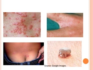 Source: Google Images
 
