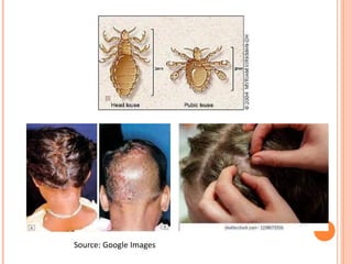 Source: Google Images
 