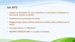 NA APS
• impacto na qualidade de vida / autoestima / preconceito e limitações na
vida social, escolar ou laboral
• Interferência na percepção de saúde
• Negligenciadas pelas políticas públicas e também pelos profissionais de
saúde
• Principal sintoma >> PRURIDO
• SEMPRE PERGUNTAR! >> contato e familiares
 