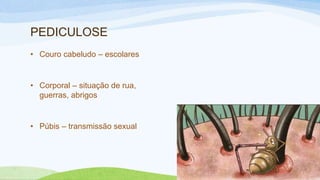 PEDICULOSE
• Couro cabeludo – escolares
• Corporal – situação de rua,
guerras, abrigos
• Púbis – transmissão sexual
 