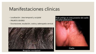 Manifestaciones clínicas
◦ Localización: área temporal y occipital
◦ PRURITO SEVERO
◦ Excoriaciones, exudación, costra y adenopatía cervical.
 