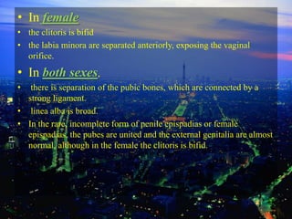 • In female
• the clitoris is bifid
• the labia minora are separated anteriorly, exposing the vaginal
  orifice.
• In both sexes,
•  there is separation of the pubic bones, which are connected by a
  strong ligament.
• linea alba is broad.
• In the rare, incomplete form of penile epispadias or female
  epispadias, the pubes are united and the external genitalia are almost
  normal, although in the female the clitoris is bifid.
 