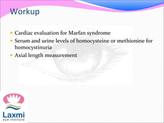 Workup
 Cardiac evaluation for Marfan syndrome
 Serum and urine levels of homocysteine or methionine for
homocystinuria
 Axial length measurement
 