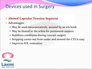 Devices used in Surgery
 Ahmed Capsular Tension Segment
 Advantages:
 May be used intraoperatively, secured by an iris hook
 May be fixated to the sclera for permanent support
 Stabilizes conditions during cataract surgery
 Stripping cortex out from under and around the CTS is easy
 Improves IOL centration
 