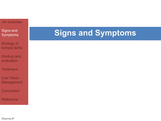 An overview 
Signs and 
Symptoms 
Etiology of 
ectopia lentis 
Workup and 
evaluation 
Treatment 
Low Vision 
Management 
Conculsion 
Reference 
Signs and Symptoms 
Sharma IP 
 
