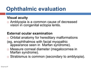 Ophthalmic evaluation 
Visual acuity 
 Amblyopia is a common cause of decreased 
vision in congenital ectopia lentis. 
External ocular examination 
 Orbital anatomy for hereditary malformations 
(eg, enophthalmos with facial myopathic 
appearance seen in Marfan syndrome). 
 Measure corneal diameter (megalocornea in 
Marfan syndrome). 
 Strabismus is common (secondary to amblyopia). 
Sharma IP 
 