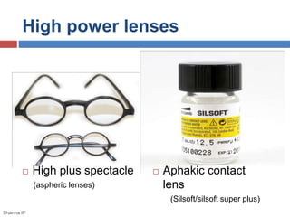 High power lenses 
 High plus spectacle 
(aspheric lenses) 
 Aphakic contact 
lens 
(Silsoft/silsoft super plus) 
Sharma IP 
 
