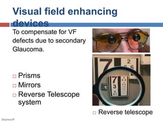 Visual field enhancing 
devices 
 Reverse telescope 
To compensate for VF 
defects due to secondary 
Glaucoma. 
 Prisms 
 Mirrors 
 Reverse Telescope 
system 
Sharma IP 
 